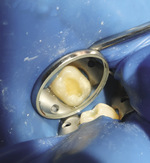 Small odbudowa4 opt