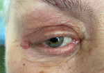 Small obraz83616 opt