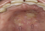 Small covid ryc1 opt