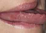 Small covid ryc2 opt