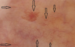 Small covid ryc3 opt
