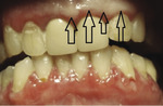 Small covid ryc4 opt