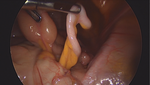 Small ryc 1 (1) opt