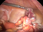 Small ryc 2 (2) opt