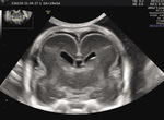 Small ryc. 2. poprzeczny prz opt