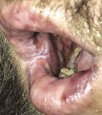 Small derm 284 rycina 2 opt