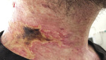 Small derm 284 rycina 3 opt