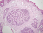 Small derm 306 rycina 4 opt
