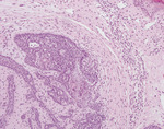 Small derm 306 rycina 5 opt