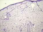 Small derm 306 rycina 6 opt