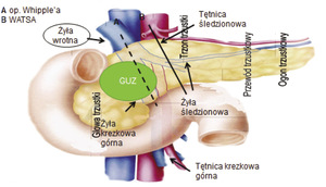 Small ryc 1 opt