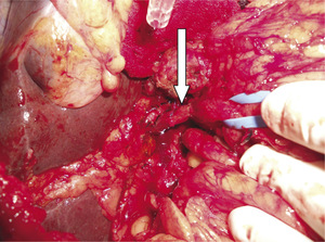 Small ryc 3 opt