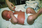 Small bernatowska 2 opt