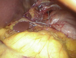 Small obraz133841 opt