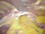 Small obraz133798 opt