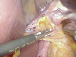 Small obraz133808 opt