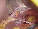 Small obraz133823 opt