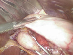 Small obraz133831 opt