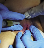 Small ryc 5 opt