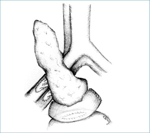 Small ryc 2 fmt
