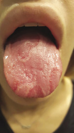 Small derm 326 rycina 3 opt