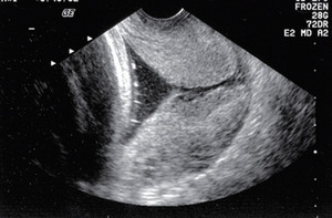 Small markham opt