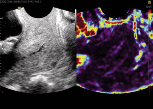Small ryc 2 opt