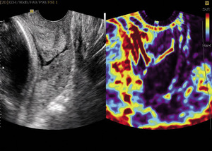 Small ryc 3 opt