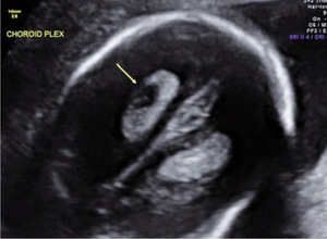 Small smfm ryc opt