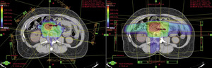 Small rycina 3 opt
