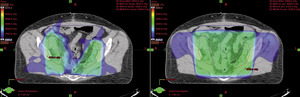 Small rycina 5 opt