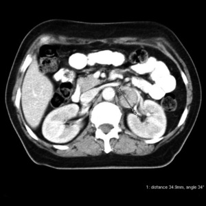 Small rycina 9 opt