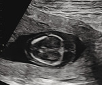 Small 5 opt