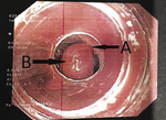 Small ryc 2 opt