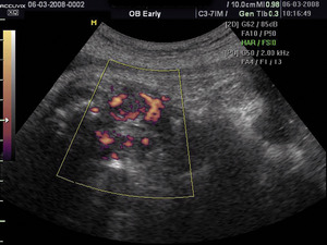 Small ryc 5 opt