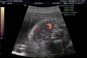 Small ryc 6 opt