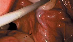 Small 8596