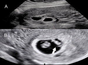 Small smfm 1 opt
