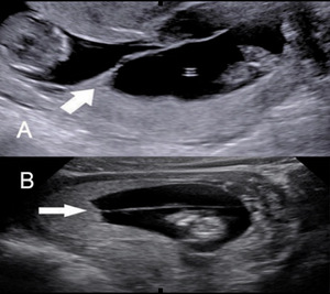 Small smfm 2 opt
