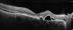 Small ryc.2 opt