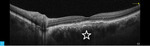 Small 1793