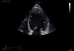 Small obraz114905 opt