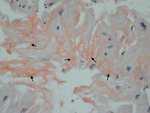 Small obraz114990 opt