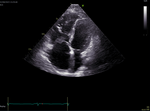 Small obraz114998 opt