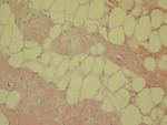 Small obraz115006 opt