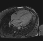 Small obraz114913 opt