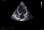 Small obraz114931 opt