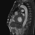 Small obraz114939 opt