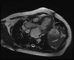 Small obraz114981 opt