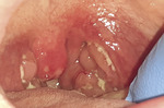 Small ryc. 3 opt